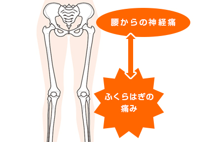 スポーツや日常生活など様々な原因で起こる下腿部(ふくらはぎ)の症状